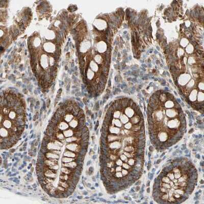 Immunohistochemistry-Paraffin: TBC1D10A Antibody [NBP1-89294] - Staining of human colon shows strong granular cytoplasmic positivity in glandular cells.