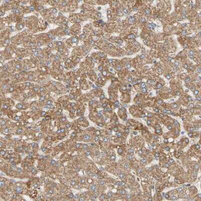 Immunohistochemistry-Paraffin: TBC1D10A Antibody [NBP1-89294] - Staining of human liver shows strong granular cytoplasmic positivity in hepatocytes.