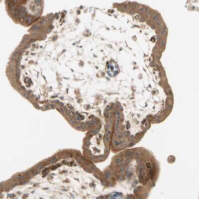 Immunohistochemistry-Paraffin: TBC1D10A Antibody [NBP1-89294] - Staining of human placenta shows strong granular cytoplasmic positivity in trophoblastic cells.