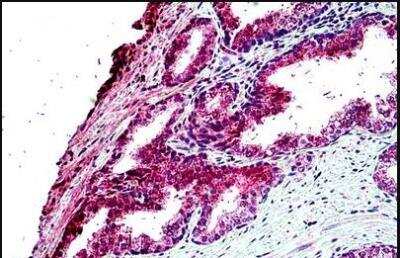 Immunohistochemistry-Paraffin: TBC1D10A Antibody [NBP2-61998] - (4.75ug/ml) staining of paraffin embedded Human Prostate. Steamed antigen retrieval with citrate buffer pH 6, AP-staining. This data is from a previous batch, not on sale.