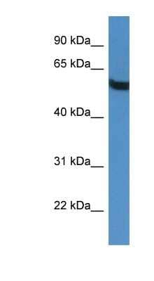 Western Blot: TBC1D10A Antibody [NBP1-79843] - HepG2 cell lysate, concentration 0.2-1 ug/ml.