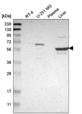 Western Blot: TBC1D10A Antibody [NBP2-58911] - Western blot analysis in human cell line RT-4, human cell line U-251 MG, human plasma and human liver tissue.