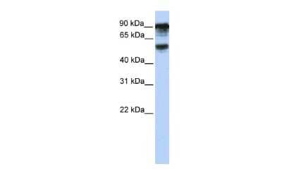 Western Blot: TBC1D10B Antibody [NBP2-83621] - WB Suggested Anti-TBC1D10B Antibody Titration: 0.2-1 ug/ml. ELISA Titer: 1:312500. Positive Control: Hela cell lysate