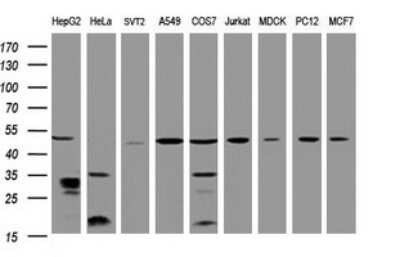 Western Blot: TBC1D13 Antibody (OTI2C5) - Azide and BSA Free [NBP2-74450] - Analysis of extracts (35ug) from 9 different cell lines by using TBC1D13 monoclonal antibody (HepG2: human; HeLa: human; SVT2: mouse; A549: human; COS7: monkey; Jurkat: human; MDCK: canine; PC12: rat; MCF7: human). Dilution: 1:2000