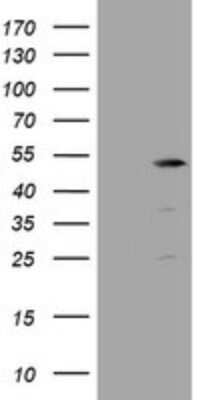 Western Blot: TBC1D13 Antibody (OTI2C5) - Azide and BSA Free [NBP2-74450] - Analysis of HEK293T cells were transfected with the pCMV6-ENTRY control (Left lane) or pCMV6-ENTRY TBC1D13.