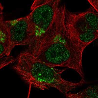 Immunocytochemistry/ Immunofluorescence TBC1D14 Antibody - BSA Free