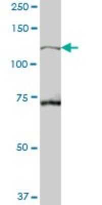 Western Blot: TBC1D2 Antibody [H00055357-B01P] - Analysis of TBC1D2 expression in human spleen.