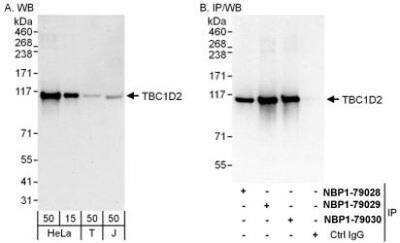 Western Blot: TBC1D2 Antibody [NBP1-79028] - Whole cell lysate from HeLa (15 and 50 mcg for WB; 1 mg for IP, 20% of IP loaded), 293T (T; 50 mcg) and Jurkat (J; 50 mcg) cells.  Antibodies: Affinity purified rabbit anti-TBC1D2 antibody used for WB at 0.04 mcg/ml (A) and 0.4 mcg/ml (B) and used for IP at 6 mcg/mg lysate.  TBC1D2 was also immunoprecipitated by rabbit anti-TBC1D2 antibodies NBP1-79029 and NBP1-79030 which recognize downstream epitopes.