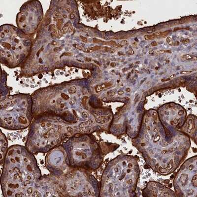 Immunohistochemistry-Paraffin: TBC1D21 Antibody [NBP1-92479] - Staining of human placenta shows strong membranous and cytoplasmic positivity in trophoblastic cells.