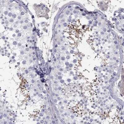 Immunohistochemistry-Paraffin: TBC1D21 Antibody [NBP1-92479] - Staining of human testis shows high expression.