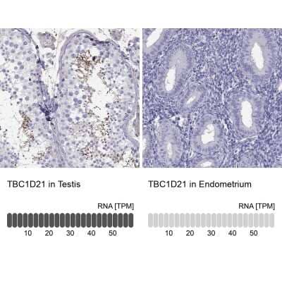 <b>Orthogonal Strategies Validation. </b>Immunohistochemistry-Paraffin: TBC1D21 Antibody [NBP1-92479] - Staining in human testis and endometrium tissues using anti-TBC1D21 antibody. Corresponding TBC1D21 RNA-seq data are presented for the same tissues.