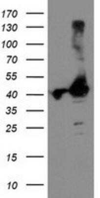 Western Blot: TBC1D21 Antibody (OTI2A6) - Azide and BSA Free [NBP2-74451] - HEK293T cells were transfected with the pCMV6-ENTRY control (Left lane) or pCMV6-ENTRY TBC1D21 (Right lane) cDNA for 48 hrs and lysed. Equivalent amounts of cell lysates (5 ug per lane) were separated by SDS-PAGE and immunoblotted with anti-TBC1D21.
