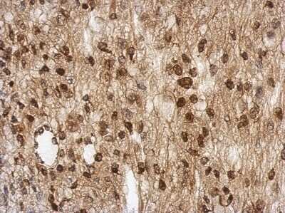 Immunohistochemistry-Paraffin TBC1D22A Antibody