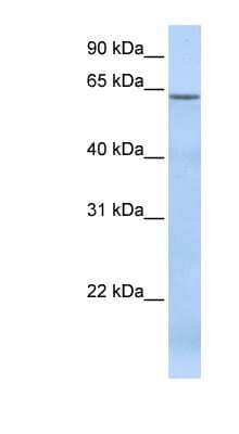 Western Blot: TBC1D22A Antibody [NBP1-70718] - Titration: 0.2-1 ug/ml, Positive Control: Human Muscle.