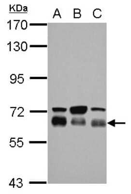 Western Blot TBC1D22A Antibody