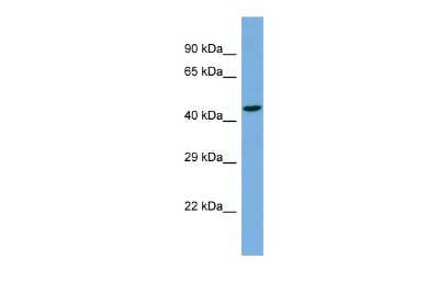 Western Blot: TBC1D22A Antibody [NBP2-88412] - Host: Rabbit. Target Name: TBC1D22A. Sample Type: NCI-H226 Whole cell lysates. Antibody Dilution: 1.0ug/ml