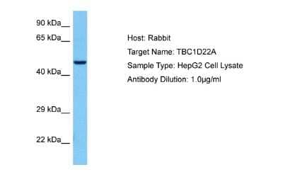 Western Blot: TBC1D22A Antibody [NBP2-88414] - Host: Rabbit. Target Name: TBC1D22A. Sample Tissue: Human HepG2 Whole Cell lysates. Antibody Dilution: 1ug/ml