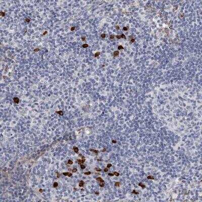Immunohistochemistry: TBC1D22B Antibody [NBP1-86751] - Staining of human lymph node shows strong positivity in a subset of cells outside reaction centra.