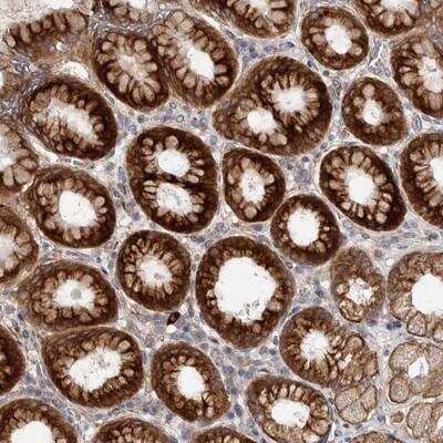 Immunohistochemistry: TBC1D22B Antibody [NBP1-86753] - Staining of human stomach shows strong cytoplasmic positivity in glandular cells.