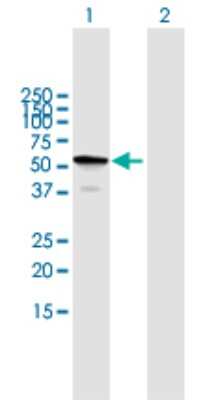 Western Blot: TBC1D22B Antibody [H00055633-B01P] - Analysis of TBC1D22B expression in transfected 293T cell line by TBC1D22B polyclonal antibody.  Lane1:TBC1D22B transfected lysate(55.55 KDa). Lane2:Non-transfected lysate.