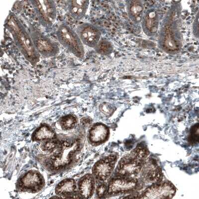 Immunohistochemistry-Paraffin TBC1D23 Antibody - BSA Free
