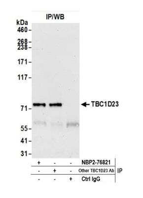 Immunoprecipitation: TBC1D23 Antibody [NBP2-76821] - Detection of human TBC1D23 by western blot of immunoprecipitates. Samples: Whole cell lysate (1.0 mg per IP reaction; 20% of IP loaded) from GAMG cells prepared using NETN lysis buffer. Antibodies: Affinity purified Rabbit anti-TBC1D23 antibody NBP2-76821 used for IP at 100 ul per reaction. TBC1D23 was also immunoprecipitated by another rabbit anti-TBC1D23 antibody. For blotting immunoprecipitated TBC1D23, NBP2-76821 was used at 1:1000. Detection: Chemiluminescence with an exposure time time of 30 seconds.