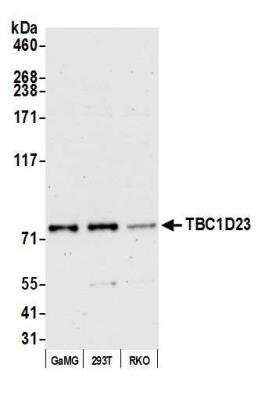 Western Blot: TBC1D23 Antibody [NBP2-76821] - Detection of human TBC1D23 by western blot of immunoprecipitates. Samples: Whole cell lysate (1.0 mg per IP reaction; 20% of IP loaded) from GAMG cells prepared using NETN lysis buffer. Antibodies: Affinity purified Rabbit anti-TBC1D23 antibody NBP2-76821 used for IP at 100 ul per reaction. For blotting immunoprecipitated TBC1D23, NBP2-76821was used at 1:1000. Detection: Chemiluminescence with an exposure time time of 30 seconds.