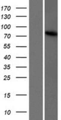 Western Blot TBC1D23 Overexpression Lysate