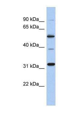 Western Blot: TBC1D26 Antibody [NBP1-57658] - Human kidney lysate, concentration 0.2-1 ug/ml.