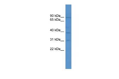 Western Blot: TBC1D26 Antibody [NBP2-85878] - WB Suggested Anti-MGC51025 Antibody Titration: 0.2-1 ug/ml. ELISA Titer: 1:1562500. Positive Control: OVCAR-3 cell lysate