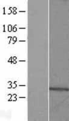 Western Blot: TBC1D26 Overexpression Lysate (Adult Normal) [NBL1-16730] Left-Empty vector transfected control cell lysate (HEK293 cell lysate); Right -Over-expression Lysate for TBC1D26.