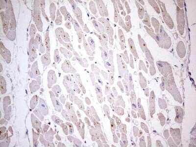 Immunohistochemistry: TBC1D28 Antibody (4A9) [NBP2-46068] - Analysis of Human adult heart tissue. (Heat-induced epitope retrieval by 1 mM EDTA in 10mM Tris, pH8.5, 120C for 3min)