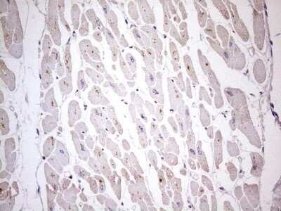 Immunohistochemistry: TBC1D28 Antibody (OTI4A9) - Azide and BSA Free [NBP2-74461] - Analysis of Human adult heart tissue. (Heat-induced epitope retrieval by 1 mM EDTA in 10mM Tris, pH8.5, 120C for 3min)