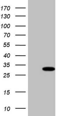 Western Blot: TBC1D28 Antibody (OTI4A9) - Azide and BSA Free [NBP2-74461] - Analysis of HEK293T cells were transfected with the pCMV6-ENTRY control (Left lane) or pCMV6-ENTRY TBC1D28.