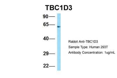 Western Blot: TBC1D3 Antibody [NBP2-86844] - Host: Rabbit. Target Name: TBC1D3. Sample Type: Human 293T. Antibody Dilution: 1.0ug/mlTBC1D3 is supported by BioGPS gene expression data to be expressed in HEK293T