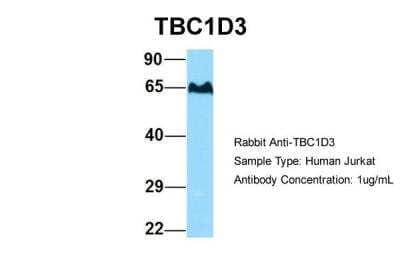Western Blot: TBC1D3 Antibody [NBP2-86844] - Host: Rabbit. Target Name: TBC1D3. Sample Type: Human Jurkat. Antibody Dilution: 1.0ug/mlTBC1D3 is supported by BioGPS gene expression data to be expressed in Jurkat