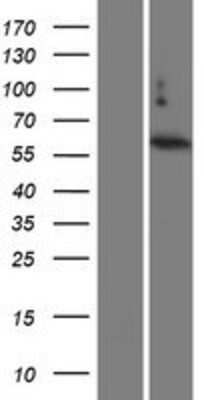 Western Blot TBC1D3 Overexpression Lysate