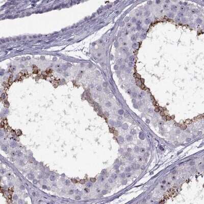 Immunohistochemistry-Paraffin: TBC1D3C Antibody [NBP2-46751] - Staining of human testis shows strong cytoplasmic positivity in cells in seminiferous ducts.