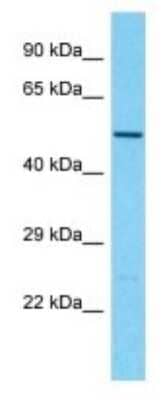 Western Blot: TBC1D3G Antibody [NBP3-09893] - Western blot analysis of TBC1D3G in MCF7 Whole Cell lysates. Antibody dilution at 1.0ug/ml