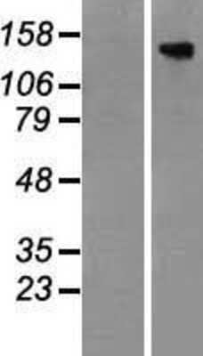 Western Blot: TBC1D4 Overexpression Lysate (Adult Normal) [NBP2-07277] Left-Empty vector transfected control cell lysate (HEK293 cell lysate); Right -Over-expression Lysate for TBC1D4.