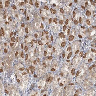 Immunohistochemistry-Paraffin: TBC1D5 Antibody [NBP1-93653] - Staining of human stomach shows moderate cytoplasmic positivity in parietal cells.