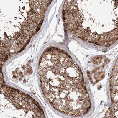 Immunohistochemistry-Paraffin: TBC1D5 Antibody [NBP2-38237] - Staining of human testis shows strong cytoplasmic positivity in cells in seminiferous ducts and Leydig cells.