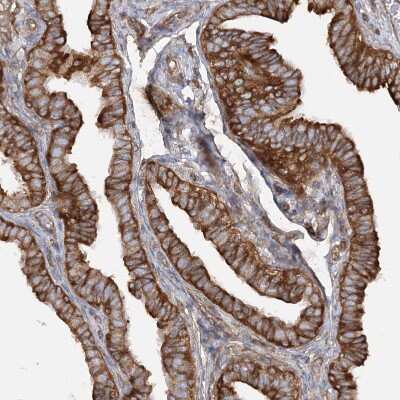 Immunohistochemistry-Paraffin: TBC1D5 Antibody [NBP2-38237] - Staining of human fallopian tube shows strong positivity in glandular cells.