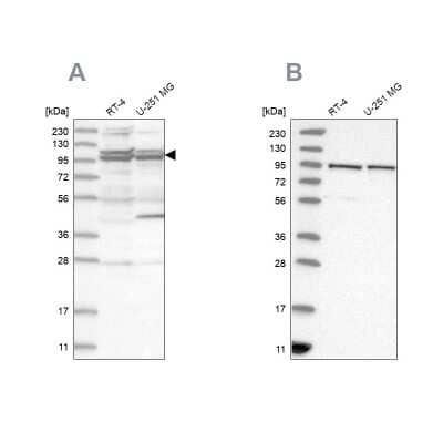 <b>Independent Antibodies Validation. </b>Western Blot: TBC1D5 Antibody [NBP1-93653] - Analysis using Anti-TBC1D5 antibody NBP1-93653 (A) shows similar pattern to independent antibody NBP2-38237 (B).