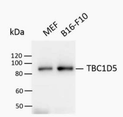 Western Blot TBC1D5 Antibody