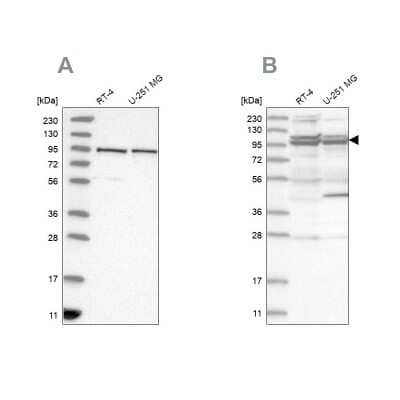 Western Blot TBC1D5 Antibody