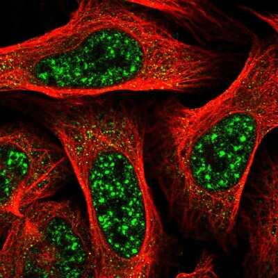 Immunocytochemistry/ Immunofluorescence TBC1D8 Antibody - BSA Free
