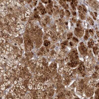 Immunohistochemistry TBC1D8B Antibody - BSA Free