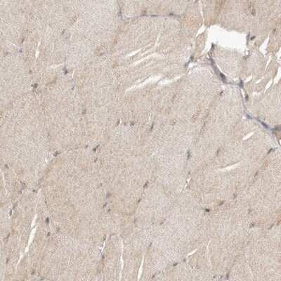Immunohistochemistry-Paraffin TBC1D8B Antibody - BSA Free