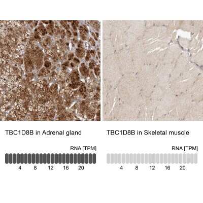 Immunohistochemistry-Paraffin TBC1D8B Antibody - BSA Free